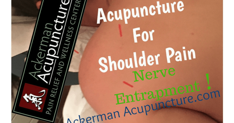 therapeutic, sport, & pain management acupuncture in minnesota